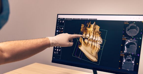 CBCT 3D Scan Analysis